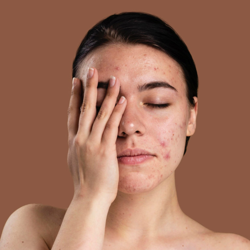 Plantas - Toxins and Reasons to Avoid